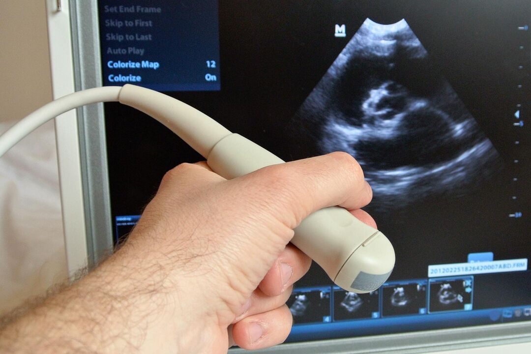 Ultrazvuk pomôže diagnostikovať kongestívnu prostatitídu u muža